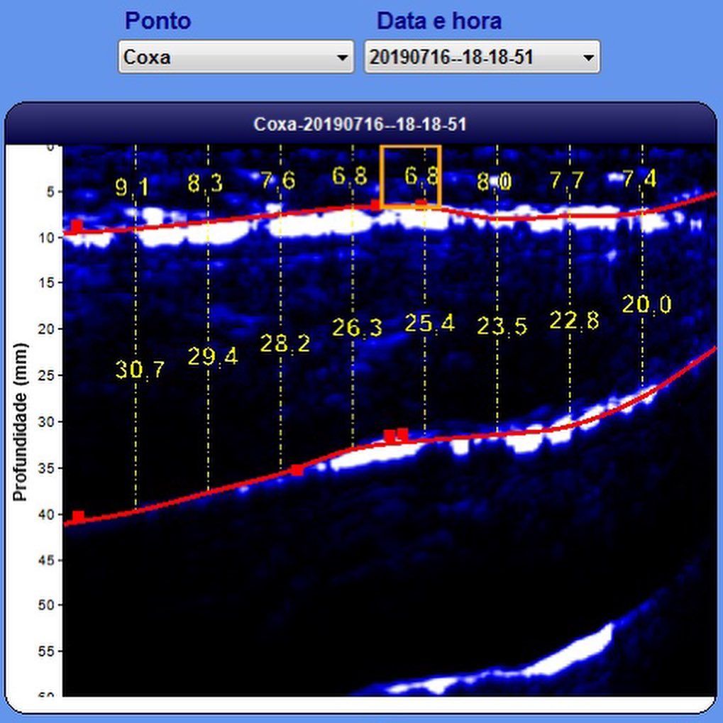 Método avançado de avaliação: Ultrassom Bodymetrix - 3