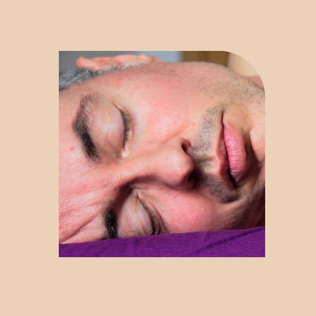 Sleep Lines - Rugas do Sono - 4