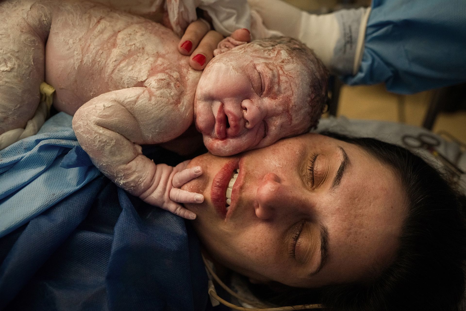 NÃO DIRIGIDAS - 1 - 1