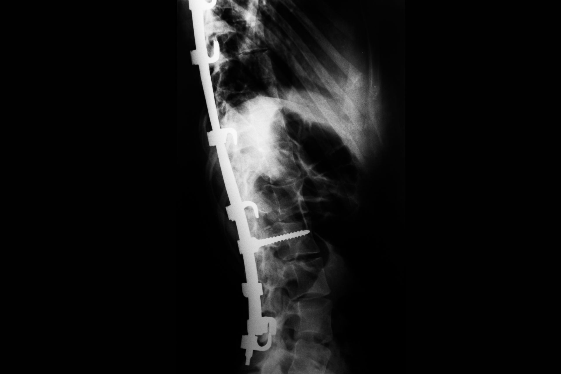 Tatuagens da Alma, Corpo e Seus Movimentos - 1 - 13