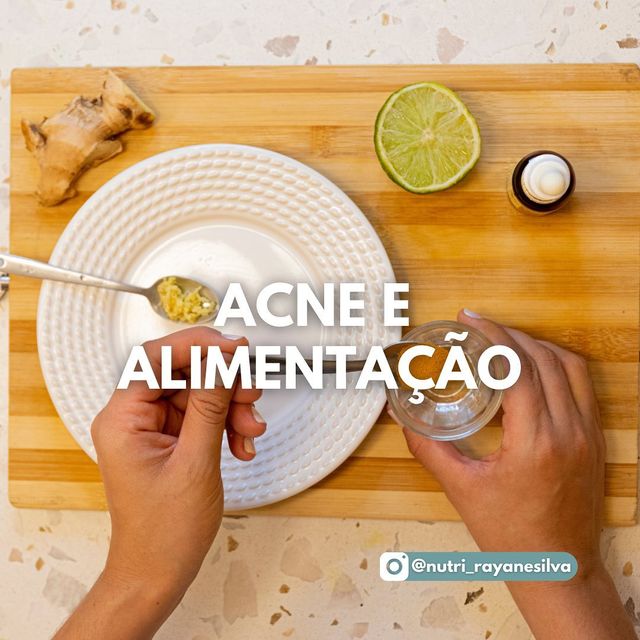 Acne e alimentação /acne-e-alimentacao2