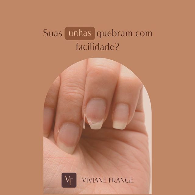 Suas unhas quebram com facilidade? Conheça os cuidados /suas-unhas-quebram-com-facilidade-conheca-os-cuidados